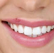 Cold Sore