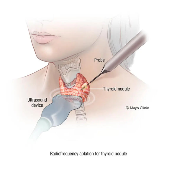 Thyroid